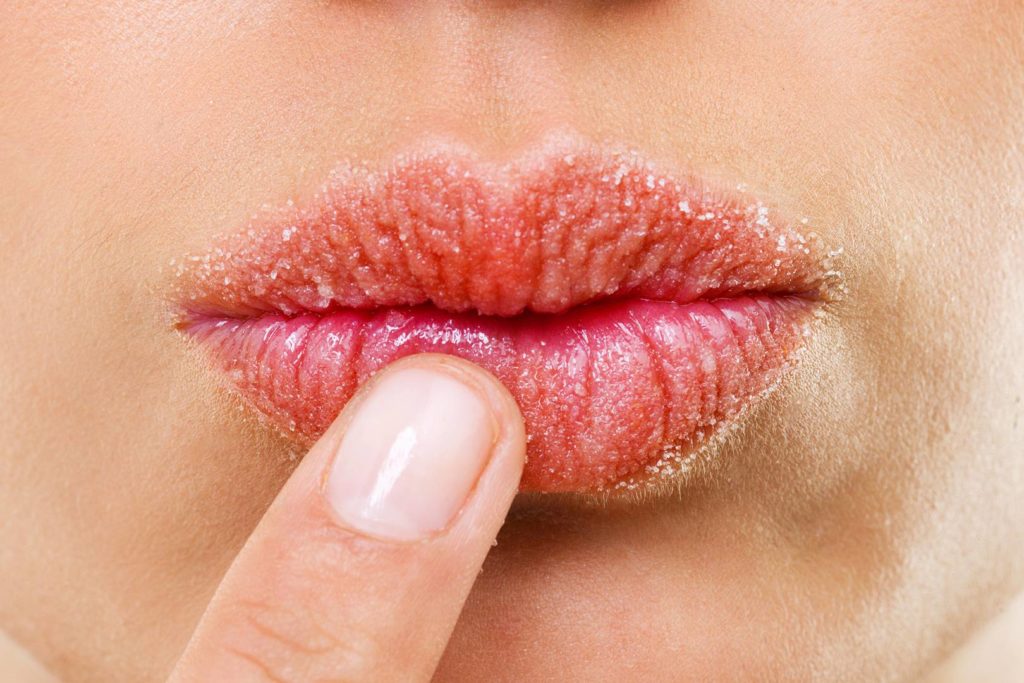 راه های پیشگیری از ترک لب