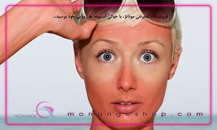 عوارض عدم استفاده از ضد آفتاب