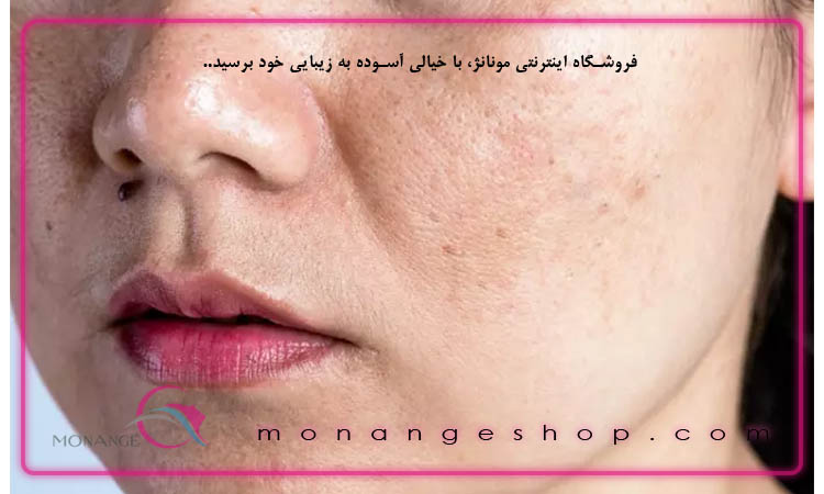 انواع روتین های پوست