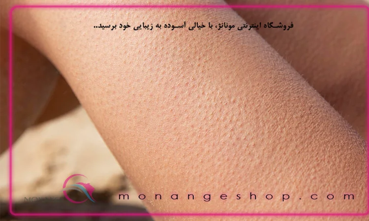 علایم خشکی پوست