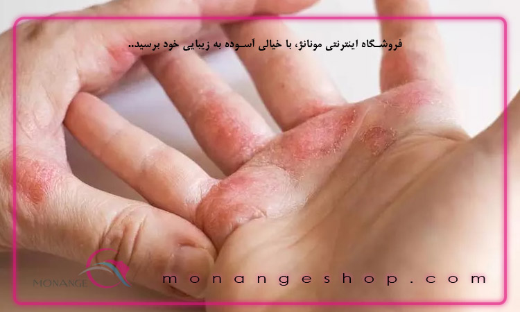 راه های درمان مشکلات پوستی