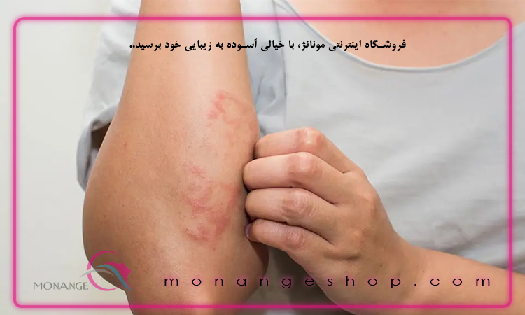 راه های پیشگیری از مشکلات پوستی
