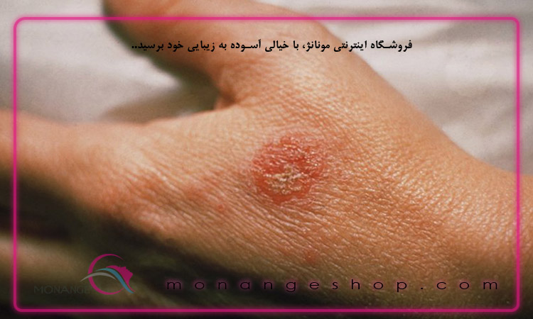 شایع ترین مشکلات پوستی + پیشگیری و درمان