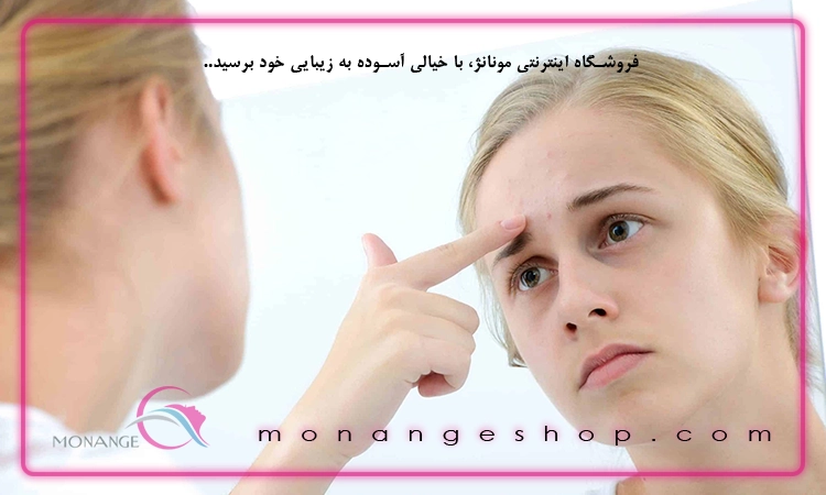 جوش و آکنه صورت