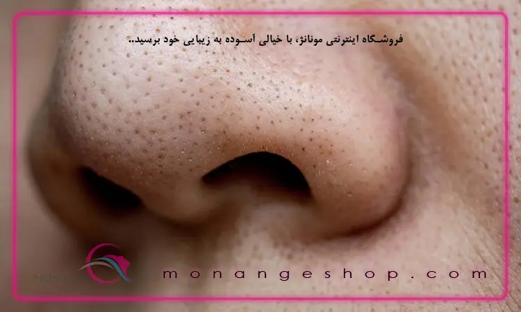 رفع جوش سر سیاه
