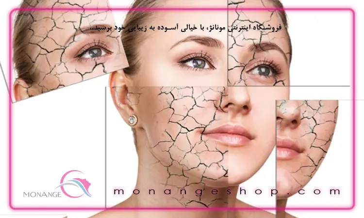 خشکی پوست بیماران