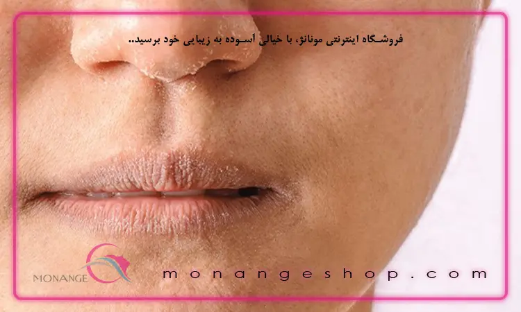 علل خشکی پوست چیست؟ راه‌ های درمان