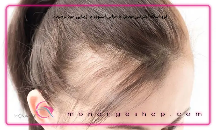 پیشگیری از ریزش مو سر