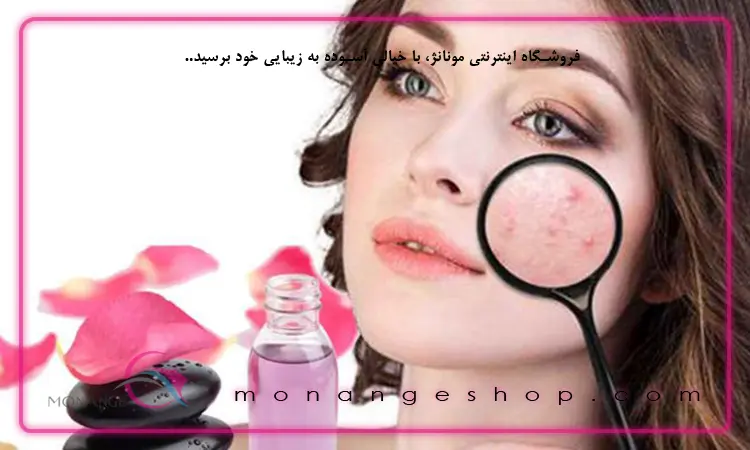 مزایای گلاب برای پوست