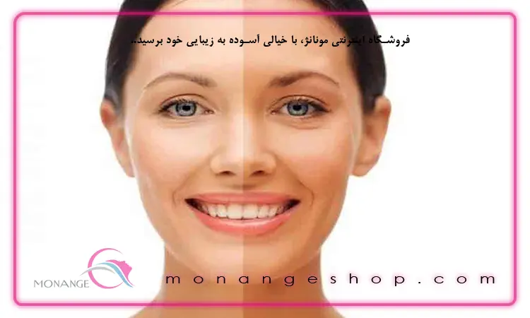 تأثیرات آفتاب بر پوست