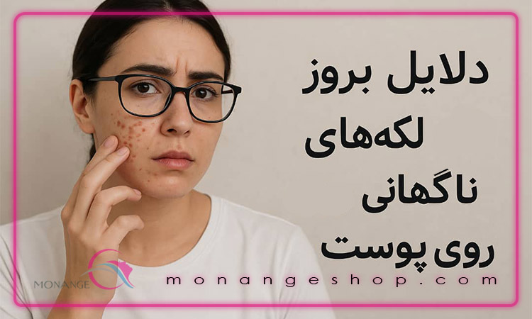 دلایل بروز لکه های ناگهانی روی پوست