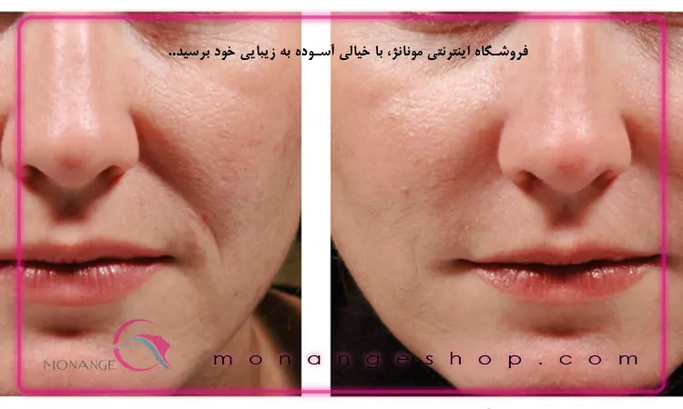خاصیت جوانسازی 