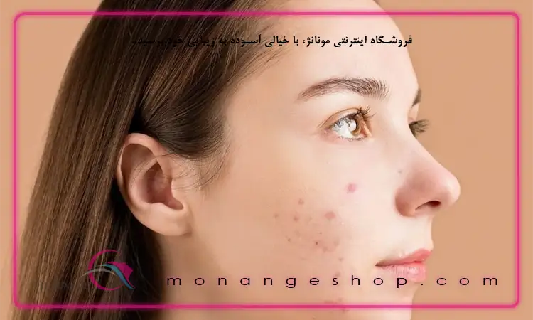 جوش بعد از اصلاح 