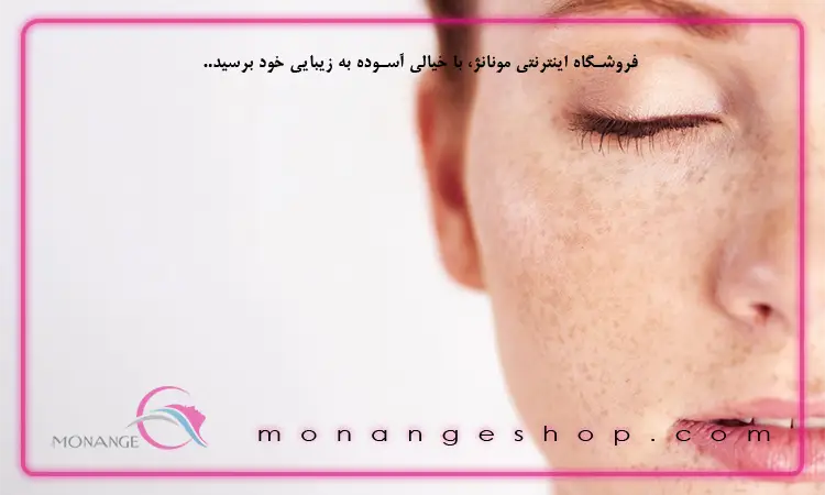 علت ایجاد لک‌ پوستی
