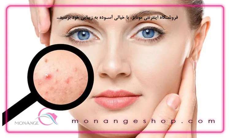 علت جوش زیر پوستی و راه های درمان