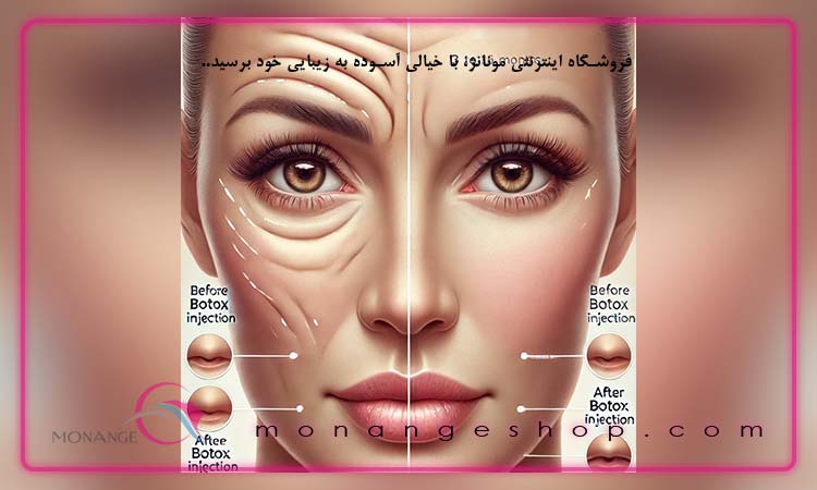 عملکرد بوتاکس و مکانیزم اثرگذاری آن