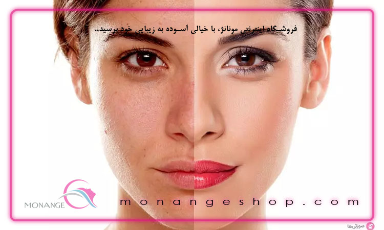 خطر آفتاب‌ سوختگی