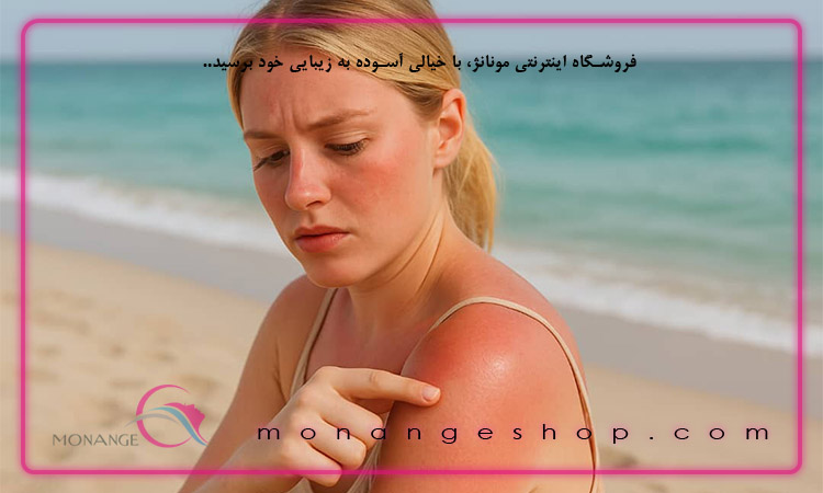 برای سفید کردن پوست آفتاب سوخته چه کنیم؟