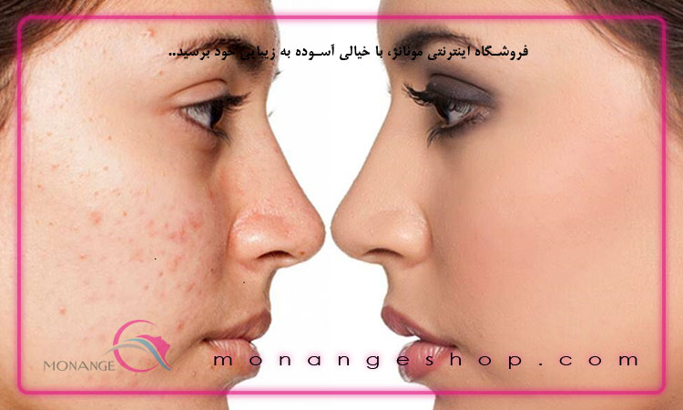 میکروبیوم پوستی