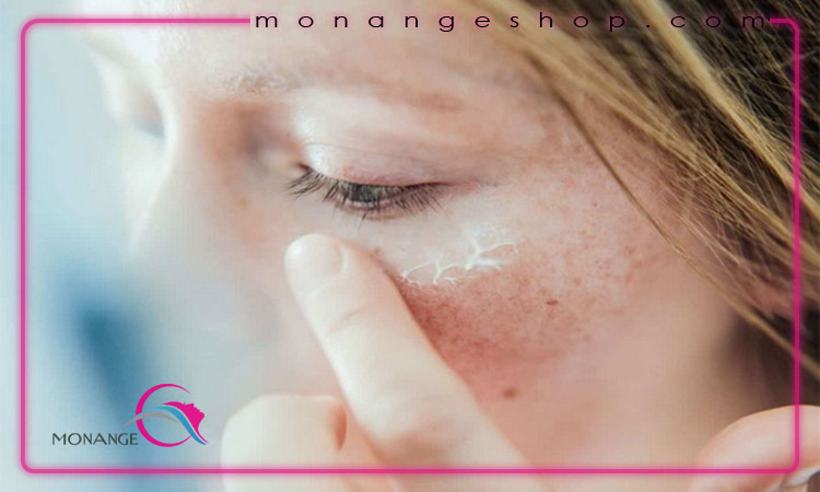 کنترل چربی و کاهش جوش