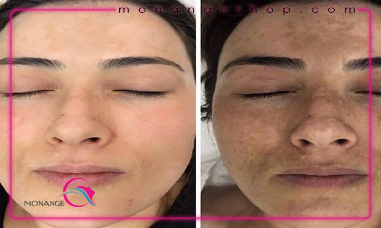 خطرات احتمالی کرم پودر دائم
