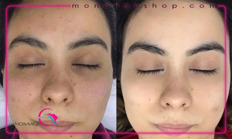 کرم پودر دائم برای چه افرادی مناسب است؟