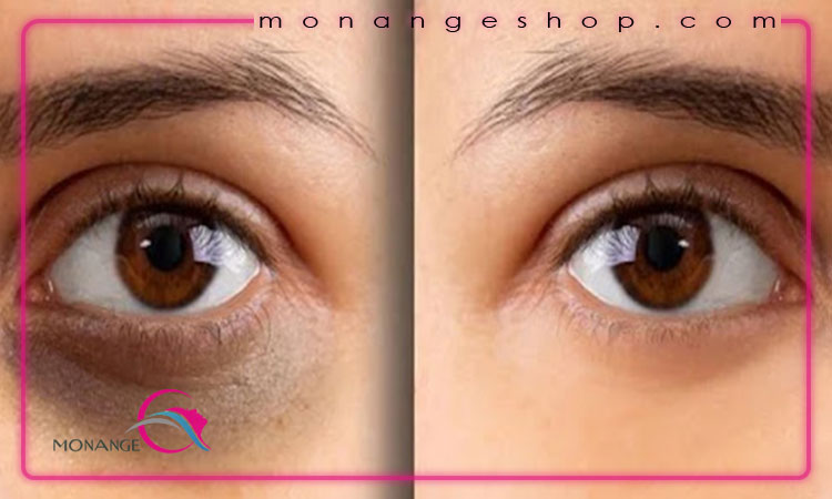 از چه سنی کرم دور چشم استفاده کنیم؟