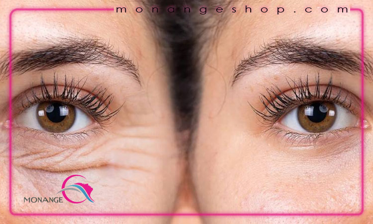ویژگی های کرم دور چشم
